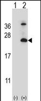 TSPAN6 Antibody (C-term)