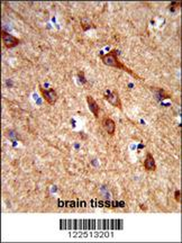 ACCN1 Antibody (Center)