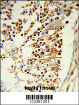 CENPH Antibody (Center)
