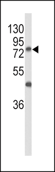 GALNT3 Antibody (Center)