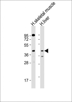ANGPTL4 Antibody (Center)