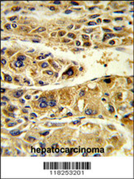 ADH6 Antibody (Center)