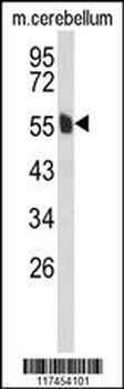 MPP6 Antibody (Center)