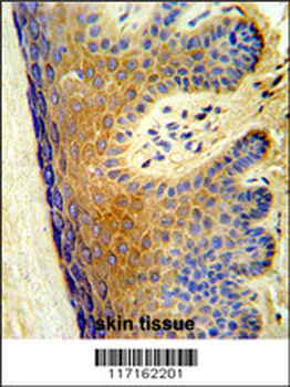 ALOX15B Antibody (C-term)