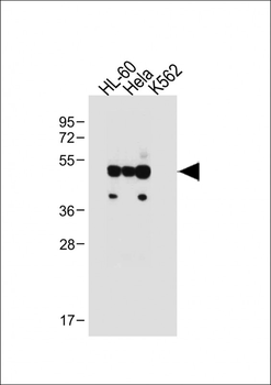FCGR1B Antibody (C-term)