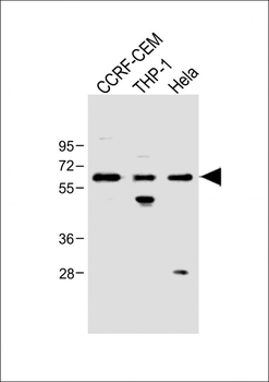 FCGR1B Antibody (C-term)