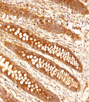 FCGR1B Antibody (C-term)