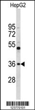 ELOVL2 Antibody (N-term)