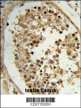 ELOVL2 Antibody (N-term)