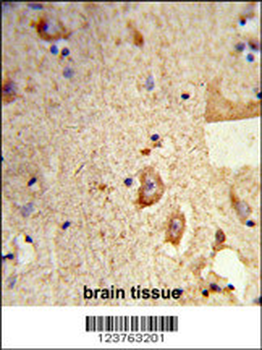 DSTN Antibody (Center)