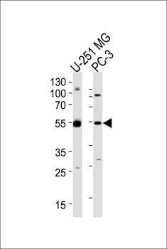 DEK Antibody (C-term)