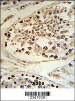 DEK Antibody (C-term)