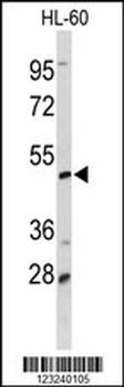 DCP2 Antibody (Center)