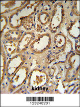 DCP2 Antibody (Center)