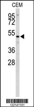 CNDP1 Antibody (C-term)