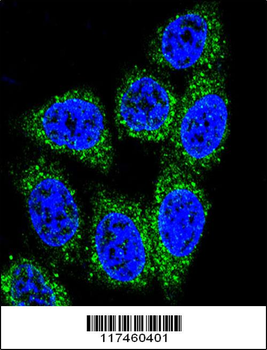 MUTYH Antibody (Center)