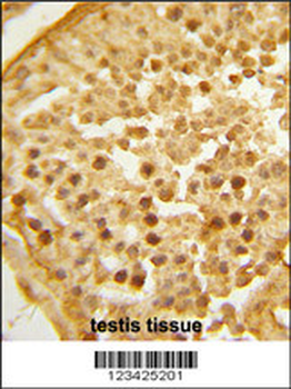 BAHD1 Antibody (C-term)