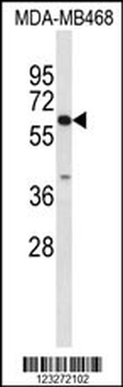 CES7 Antibody (Center)