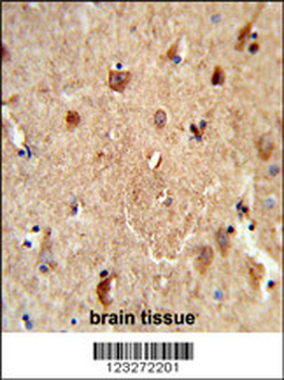 CES7 Antibody (Center)