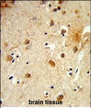 HRIHFB2025 Antibody (C-term)