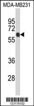 ANKRD13C Antibody (N-term)