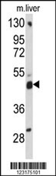 ACBD5 Antibody (N-term)