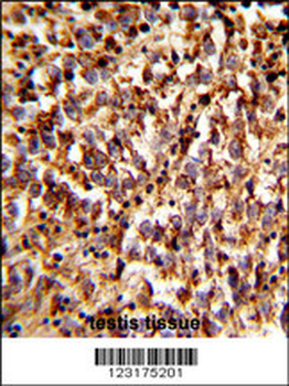 ACBD5 Antibody (N-term)