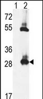 TPK1 Antibody (N-term)