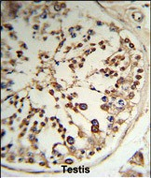 TPK1 Antibody (N-term)