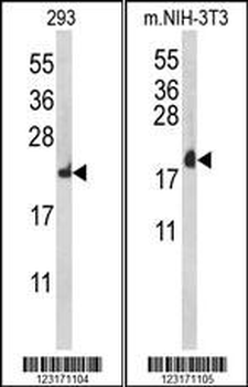 RPL18A Antibody (C-term)