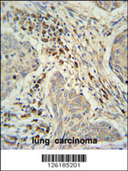 KXD1 Antibody (Center)