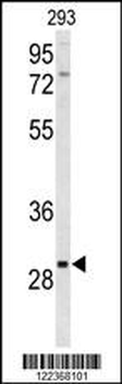 CLRN3 Antibody (C-term)