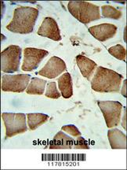 DIPA Antibody (Center)
