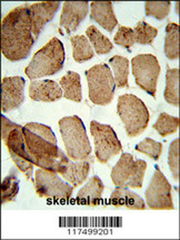 Denatured ATG1 Antibody