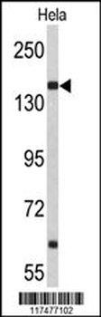NUP153 Antibody (N-term)