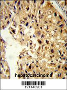 PCBD1 Antibody (Center)