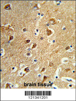 PPM1H Antibody (Center)