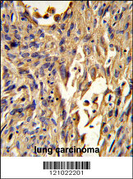 S100A10 Antibody (Center)