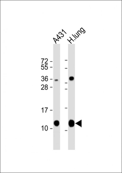 S100A10 Antibody (Center)
