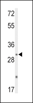 DUSP2 Antibody (C-term)