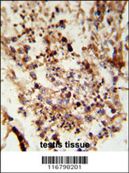 ACR Antibody (C-term)