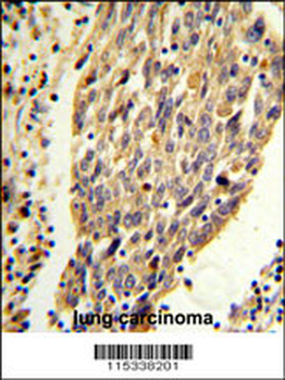 PKM2 (N-term E131) Antibody