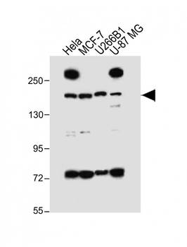 UTY Antibody (C-term)