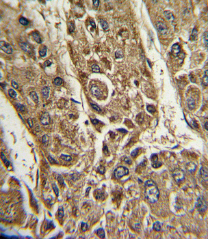 MTTP Antibody (C-term)