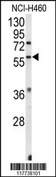 ESRRB Antibody (Center)