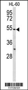 BPI Antibody (Center)