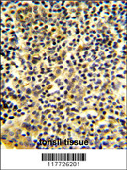 BPI Antibody (Center)