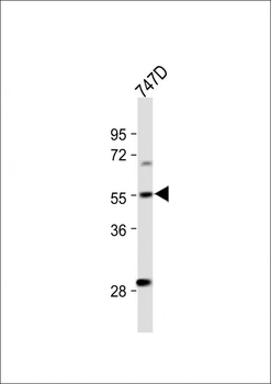 CYP27B1 Antibody (C-term)