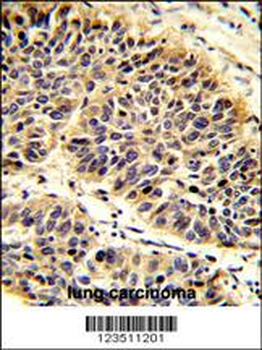 RABAC1 Antibody (N-term)