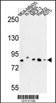 CHPF Antibody (Center)